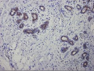 Figure 3. Immunohistochemistry of MUB0316P on paraffin section of human breast. Positive staining of lobuli and ducti.